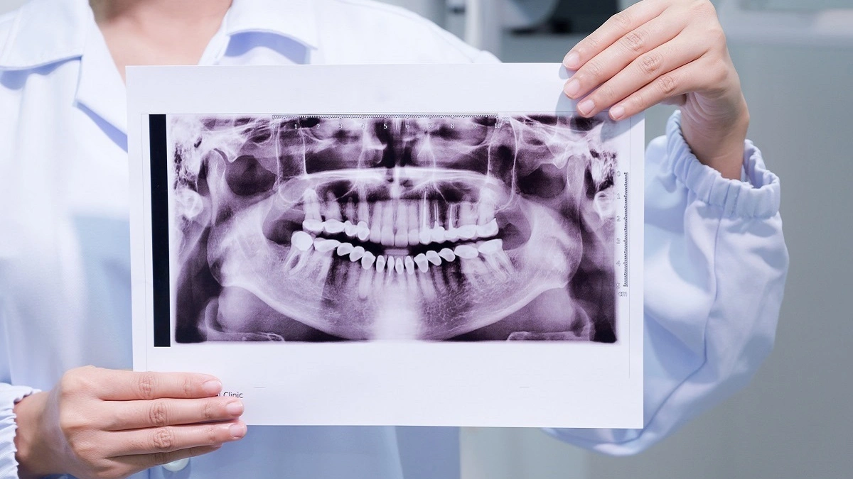 رادیولوژی دهان و فک و صورت در کرج