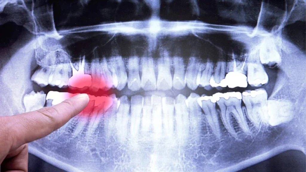 انواع تصاویر در رادیولوژی دهان و فک و صورت در کرج 