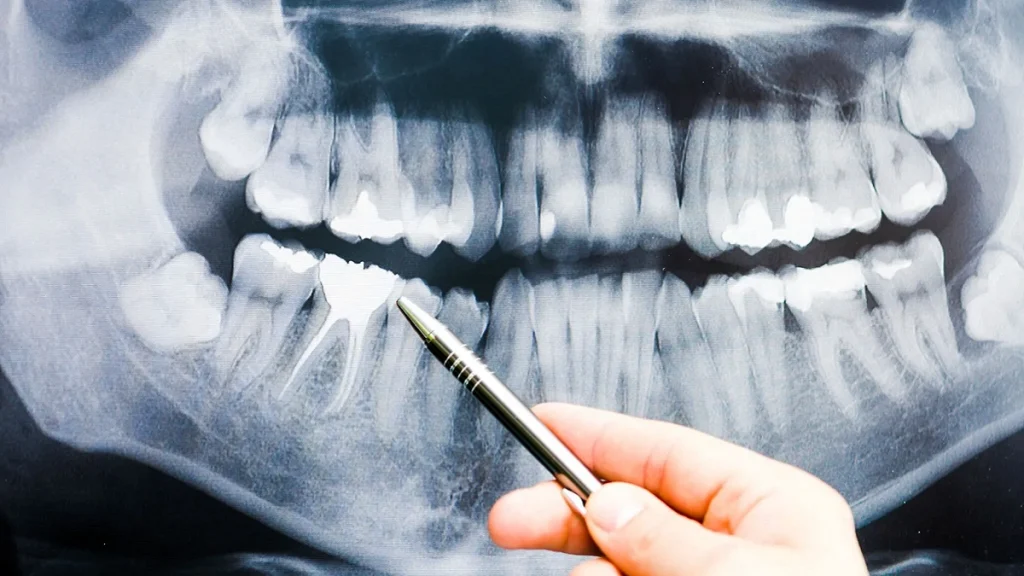 رادیولوژی دهان و فک و صورت در کرج با تصاویر سه بعدی 