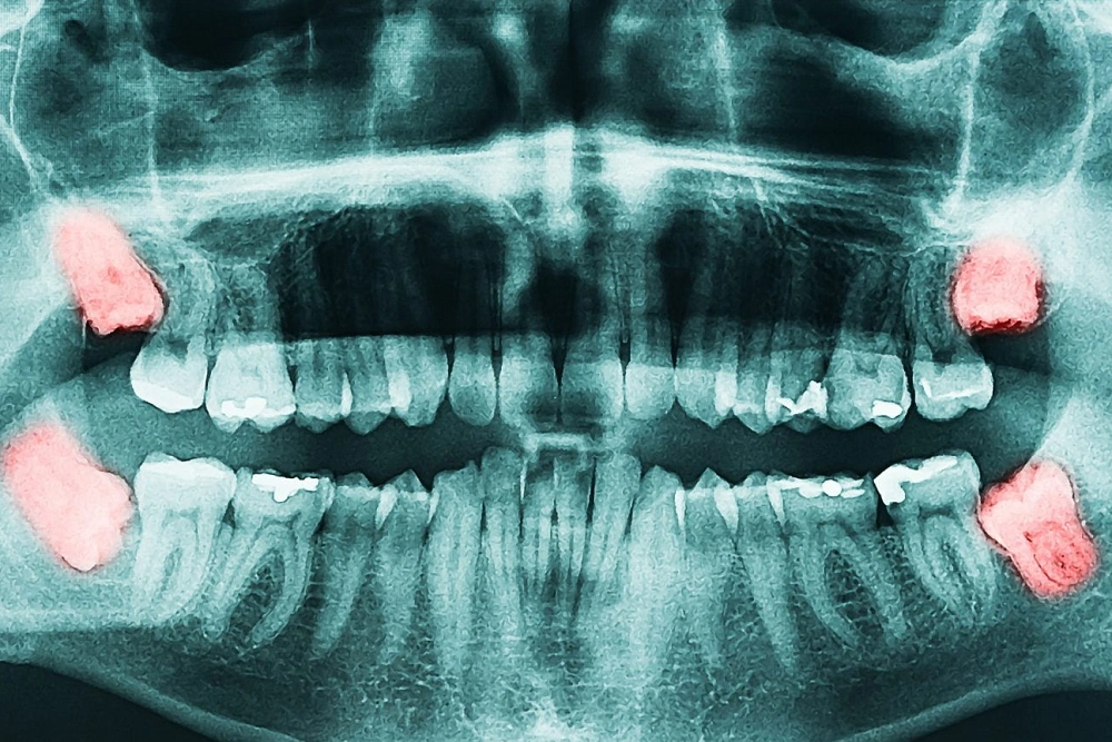 مزایای بایت وینگ گلشهر