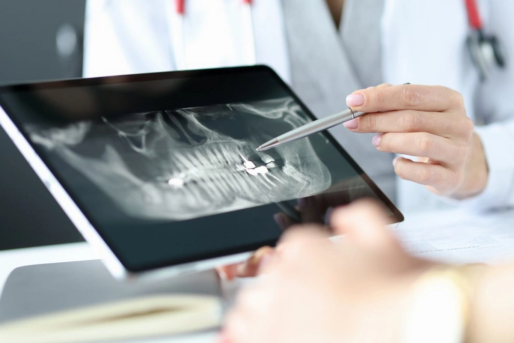 همه چیز درباره گرافی بایت وینگ گلشهر: نحوه انجام و مزایا