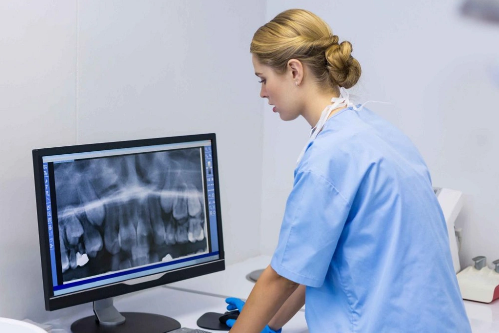 نمای پری اپیکال: راهنمای کامل تصویربرداری دندانی برای تشخیص دقیق