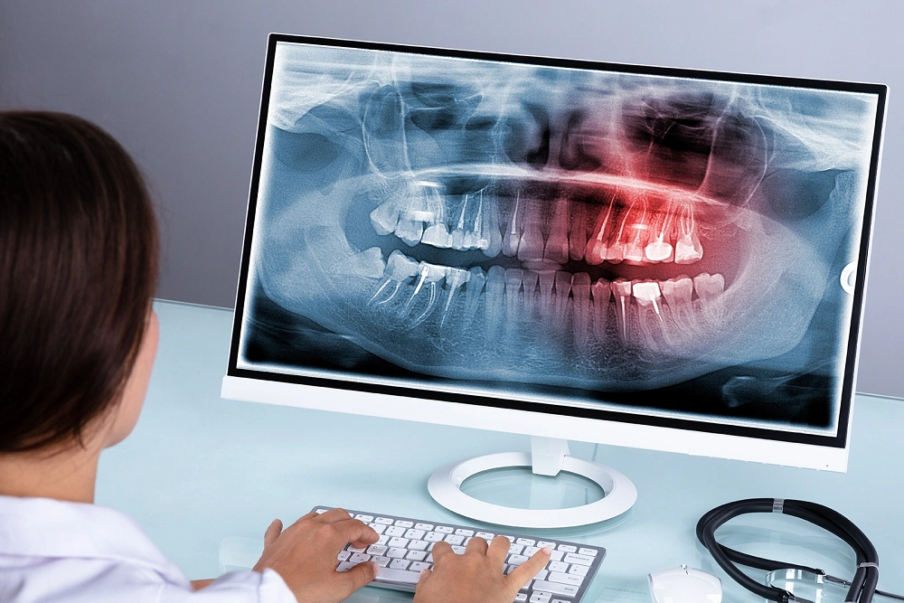 ویژگی های بهترین مرکز تصویربرداری پری اپیکال