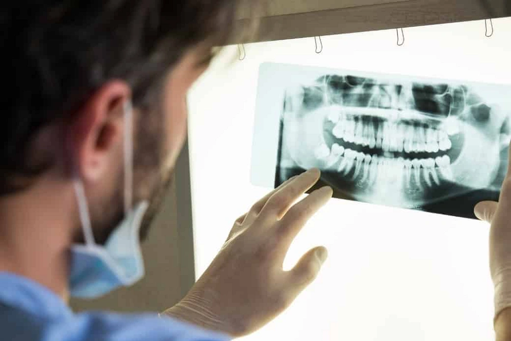 کاربردهای گرافی بایت وینگ گلشهر