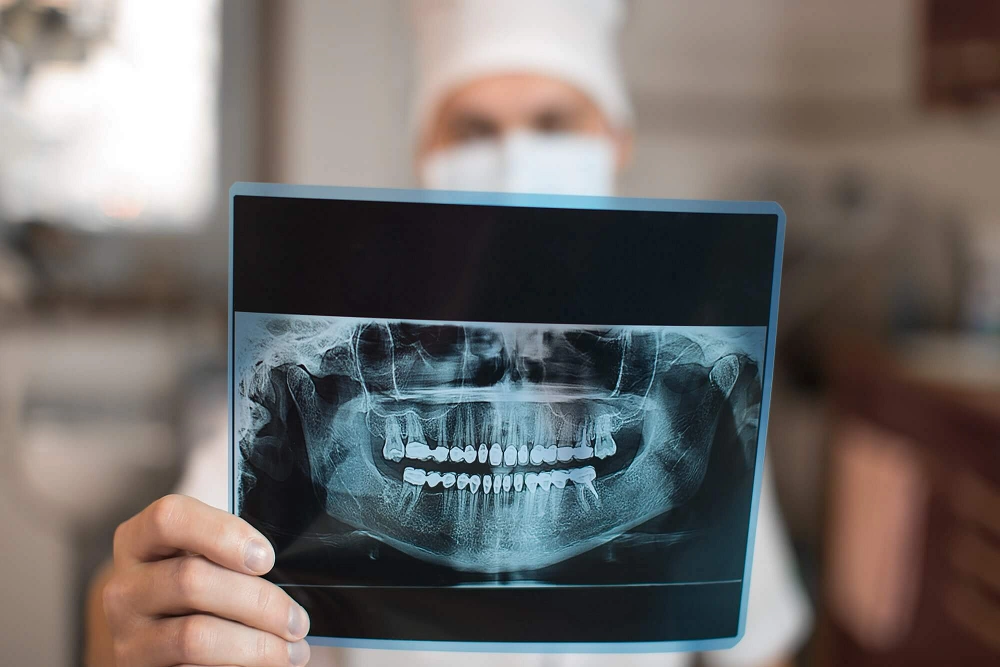 اهمیت نمای پری اپیکال