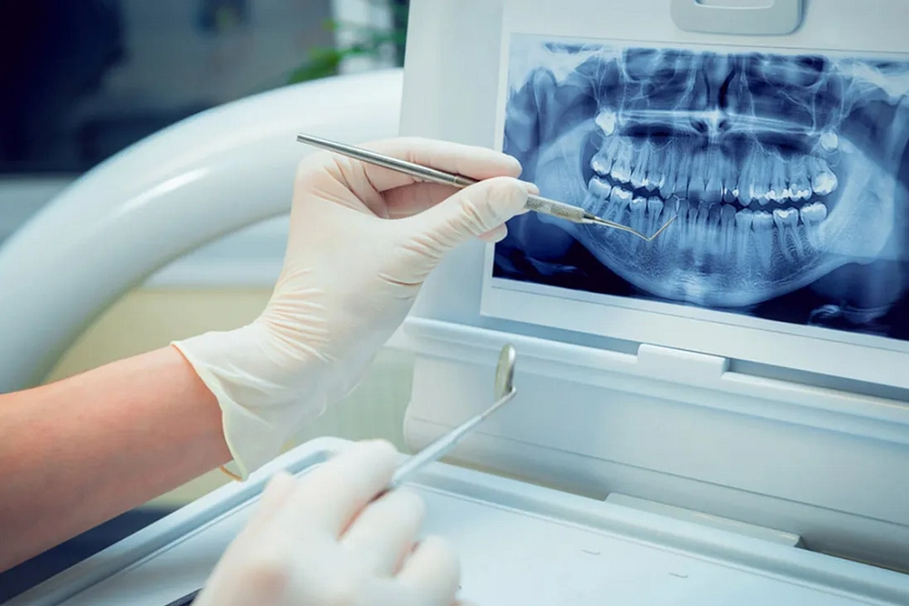 ایمنی بایت وینگ مولر راست