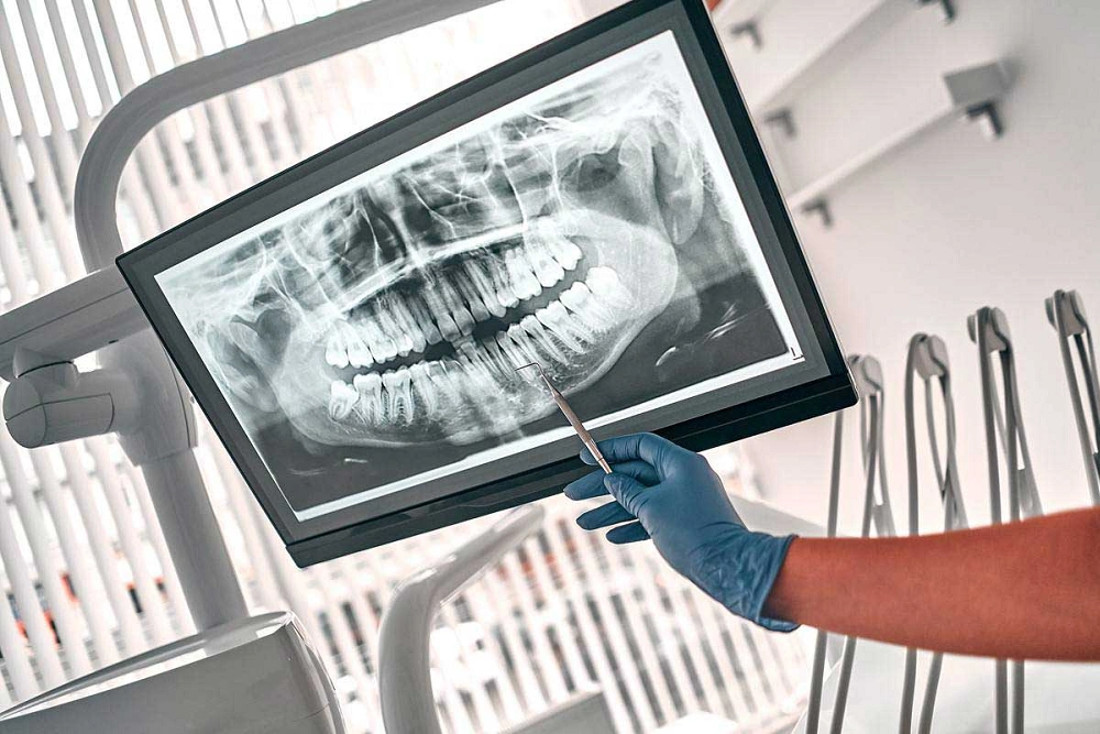 خطرات رادیوگرافی پری اپیکال چیست