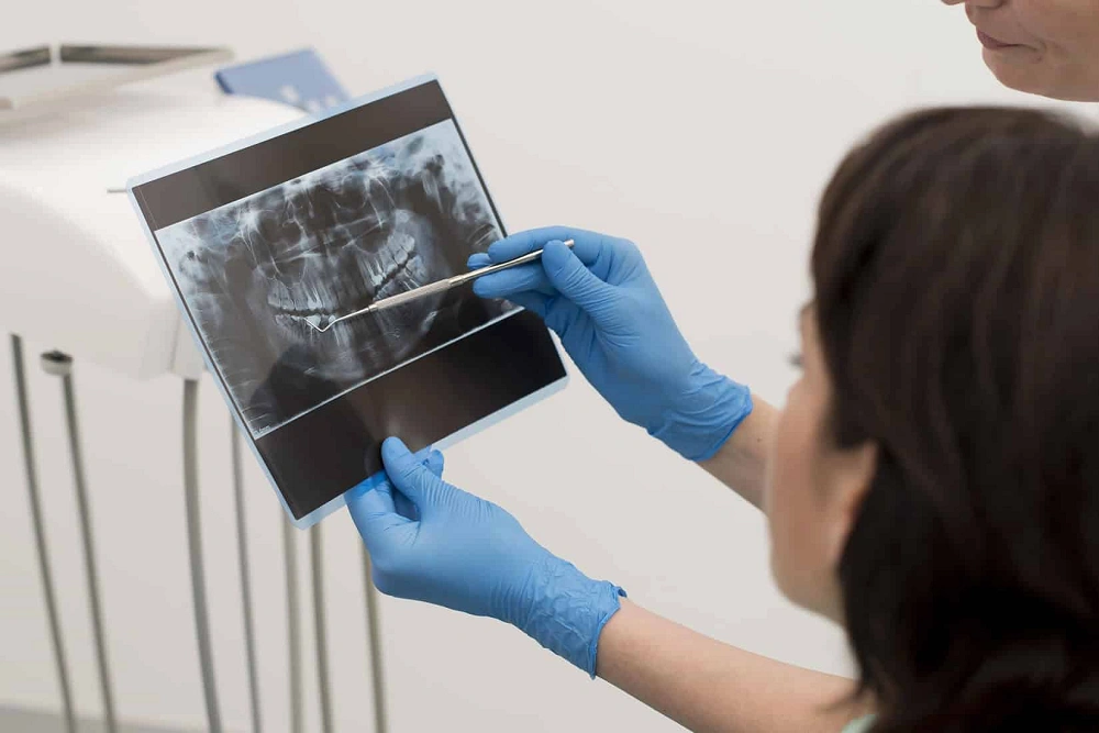 گرافی پری اپیکال دندان چیست؟