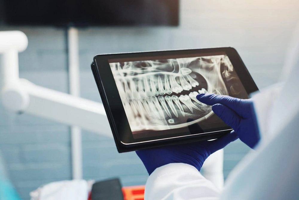 خطاهای رایج تکنیک بایت وینگ