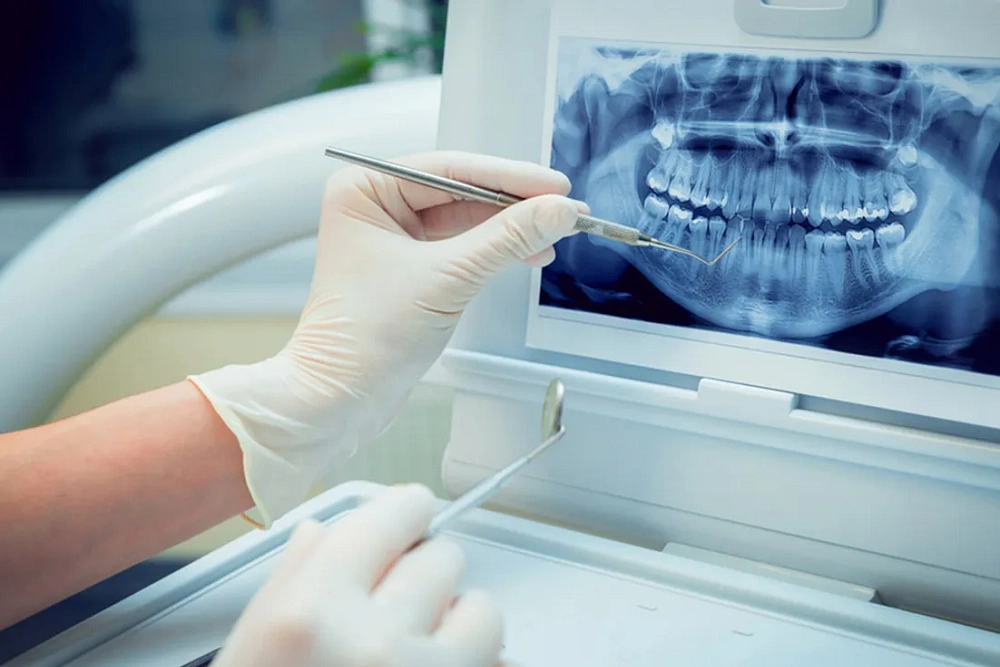 بایت وینگ یعنی چی؟ بررسی کاربردها