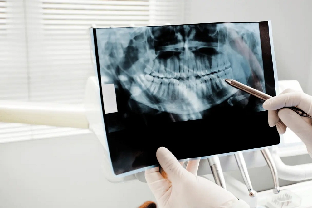 رادیوگرافی پری اپیکال قیمت، بررسی کاربردها