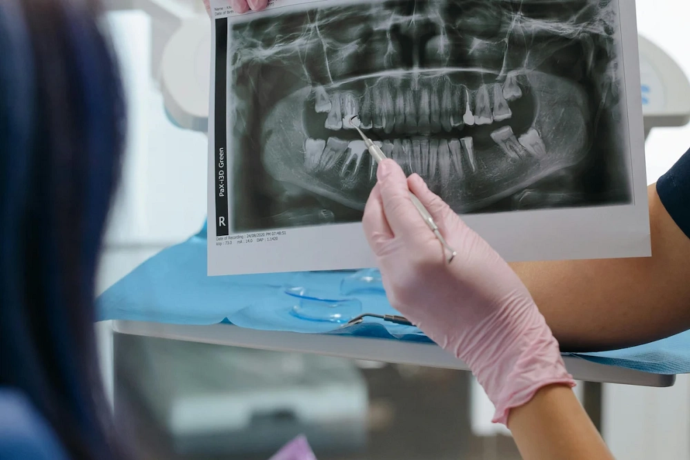 بایت وینگ یعنی چی؟ بررسی مراحل