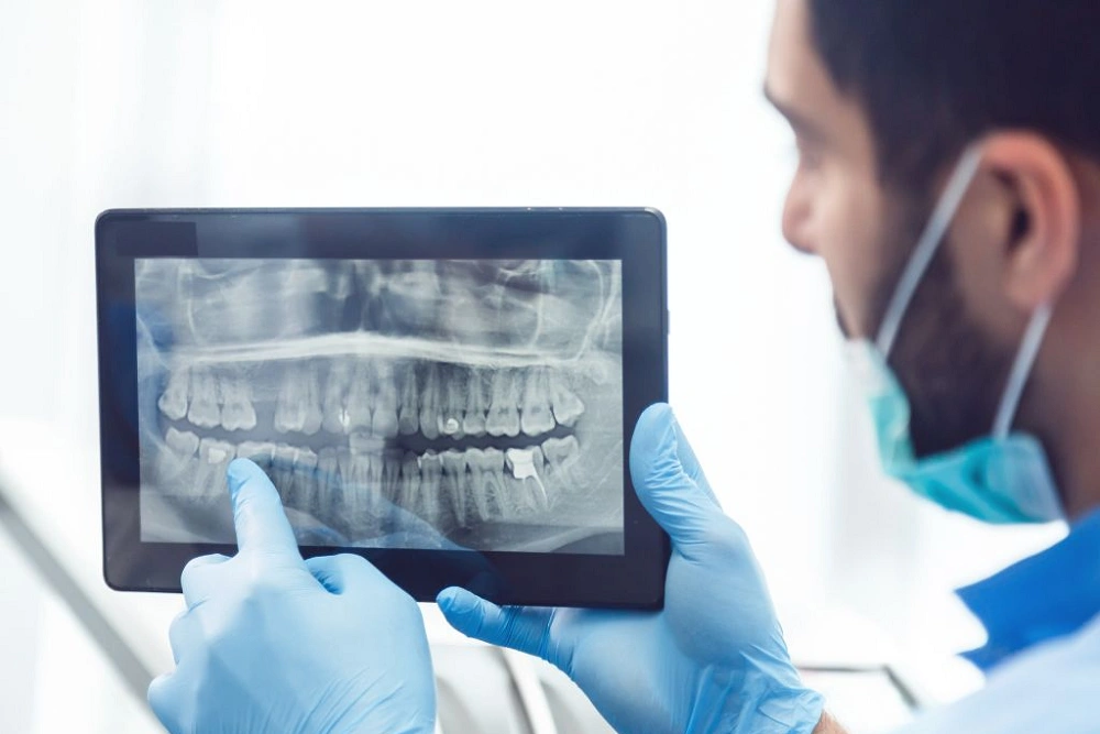 رادیوگرافی پری اپیکال قیمت، بررسی عوامل