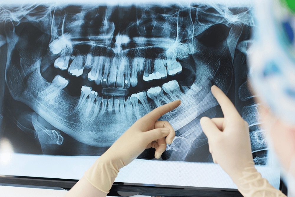 بایت وینگ یعنی چی؟ تفسیر نتایج